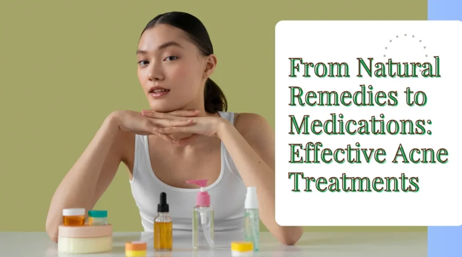 From Natural Remedies to Medications: Effective Acne Treatments