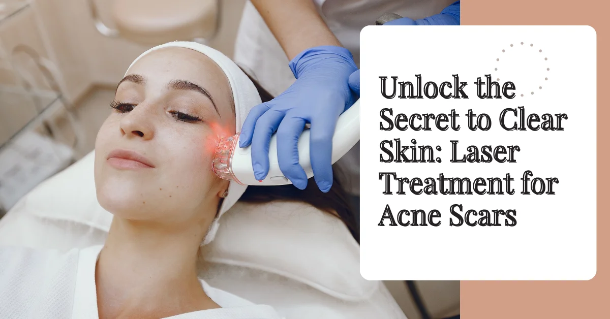 Unlock the Secret to Clear Skin Laser Treatment for Acne Scars