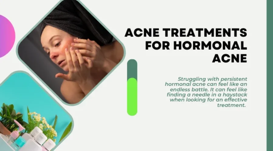 Acne Treatments for Hormonal Acne