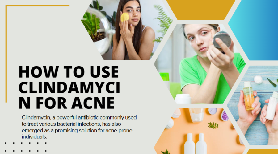 How to Use Clindamycin for Acne a Comprehensive Guide