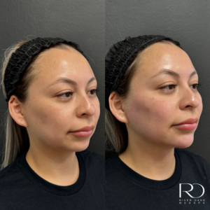 river-oaks-medspa