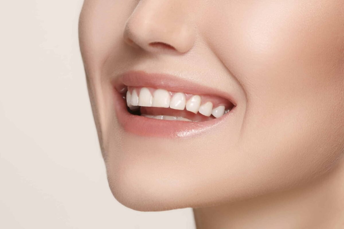 White teeth dentistry