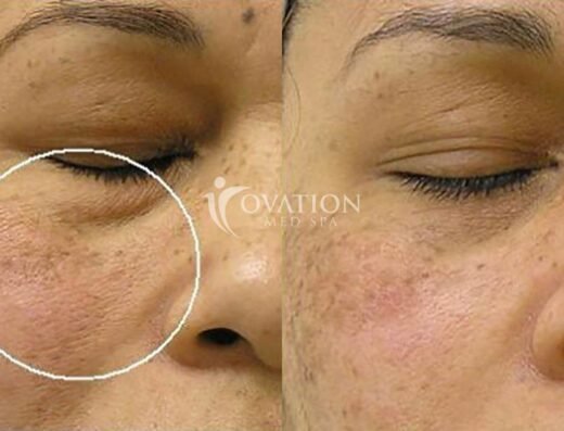 Ovation Medspa
