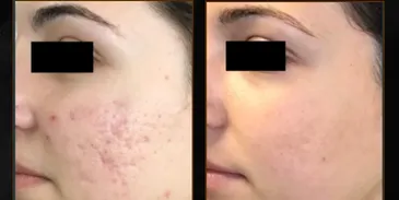 Medspa-amora